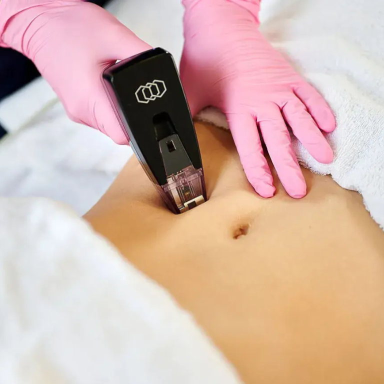 Untitled design - 2025-03-18T144507.065